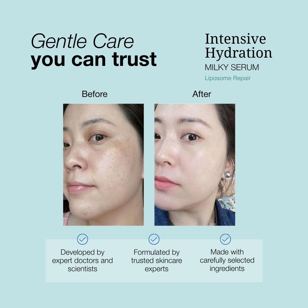Intensive Hydration Milky Serum Liposomes Repair