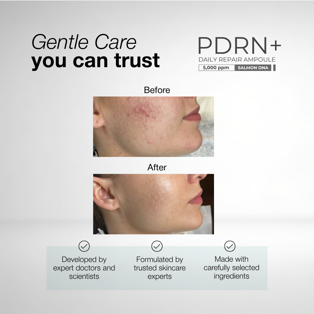 PDRN+ Daily Repair Ampoule | With 5,000ppm Salmon DNA