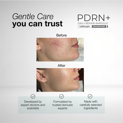PDRN+ Daily Repair Ampoule | With 5,000ppm Salmon DNA