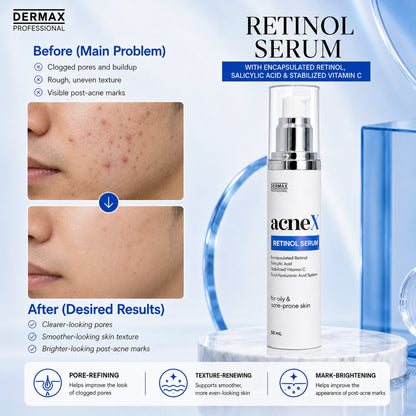 AcneX Retinol Serum 50 mL
