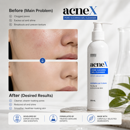 AcneX Pore Clearing Gel Cleanser